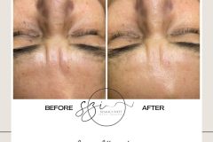 szakaly-ivett-kozmetikus-hagyomanyos-kozmetikai-kezelesek-elektrokozmetika-arckezelesek-testkezelesek-56