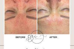 szakaly-ivett-kozmetikus-hagyomanyos-kozmetikai-kezelesek-elektrokozmetika-arckezelesek-testkezelesek-57