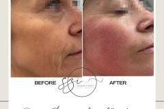 szakaly-ivett-kozmetikus-hagyomanyos-kozmetikai-kezelesek-elektrokozmetika-arckezelesek-testkezelesek-58