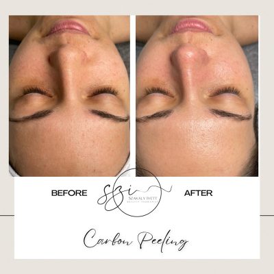 szakaly-ivett-kozmetikus-hagyomanyos-kozmetikai-kezelesek-elektrokozmetika-arckezelesek-testkezelesek-186