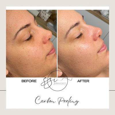 szakaly-ivett-kozmetikus-hagyomanyos-kozmetikai-kezelesek-elektrokozmetika-arckezelesek-testkezelesek-187