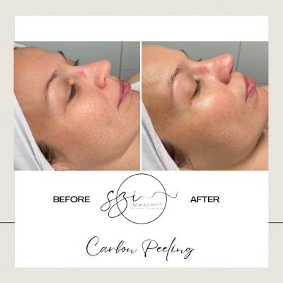 szakaly-ivett-kozmetikus-hagyomanyos-kozmetikai-kezelesek-elektrokozmetika-arckezelesek-testkezelesek-188