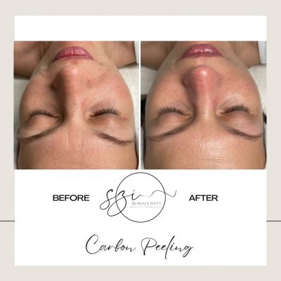 szakaly-ivett-kozmetikus-hagyomanyos-kozmetikai-kezelesek-elektrokozmetika-arckezelesek-testkezelesek-189