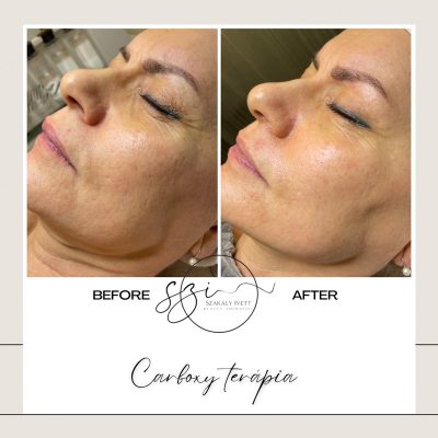 szakaly-ivett-kozmetikus-hagyomanyos-kozmetikai-kezelesek-elektrokozmetika-arckezelesek-testkezelesek-131