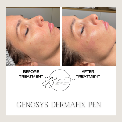 543F899C-4ACF-4953-8969-1D5146D6C134