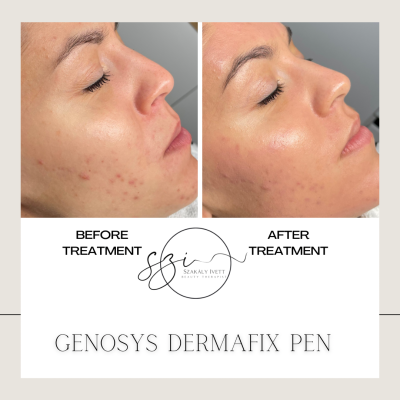 D60C4175-A044-45FF-B955-3FCD3EEBC036