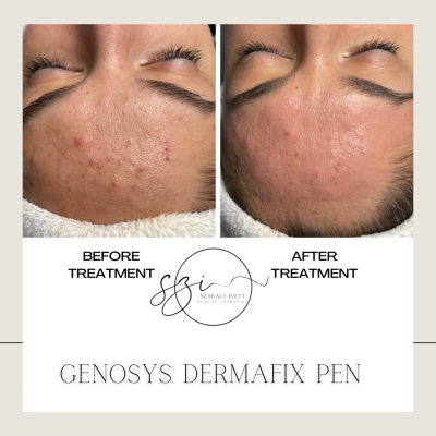 DC214915-57CA-49A0-A530-7548D28FBBBC