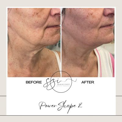 szakaly-ivett-kozmetikus-hagyomanyos-kozmetikai-kezelesek-elektrokozmetika-arckezelesek-testkezelesek-72