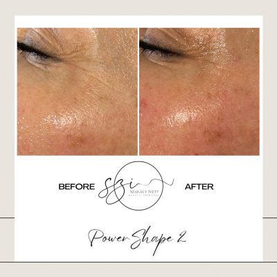 szakaly-ivett-kozmetikus-hagyomanyos-kozmetikai-kezelesek-elektrokozmetika-arckezelesek-testkezelesek-73