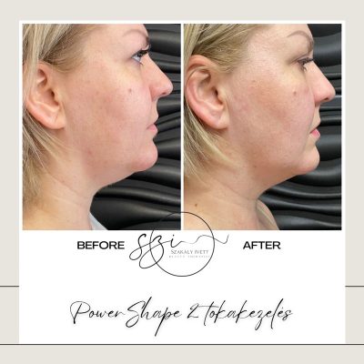 szakaly-ivett-kozmetikus-hagyomanyos-kozmetikai-kezelesek-elektrokozmetika-arckezelesek-testkezelesek-74