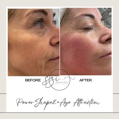 szakaly-ivett-kozmetikus-hagyomanyos-kozmetikai-kezelesek-elektrokozmetika-arckezelesek-testkezelesek-75