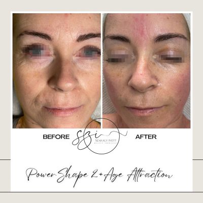 szakaly-ivett-kozmetikus-hagyomanyos-kozmetikai-kezelesek-elektrokozmetika-arckezelesek-testkezelesek-76